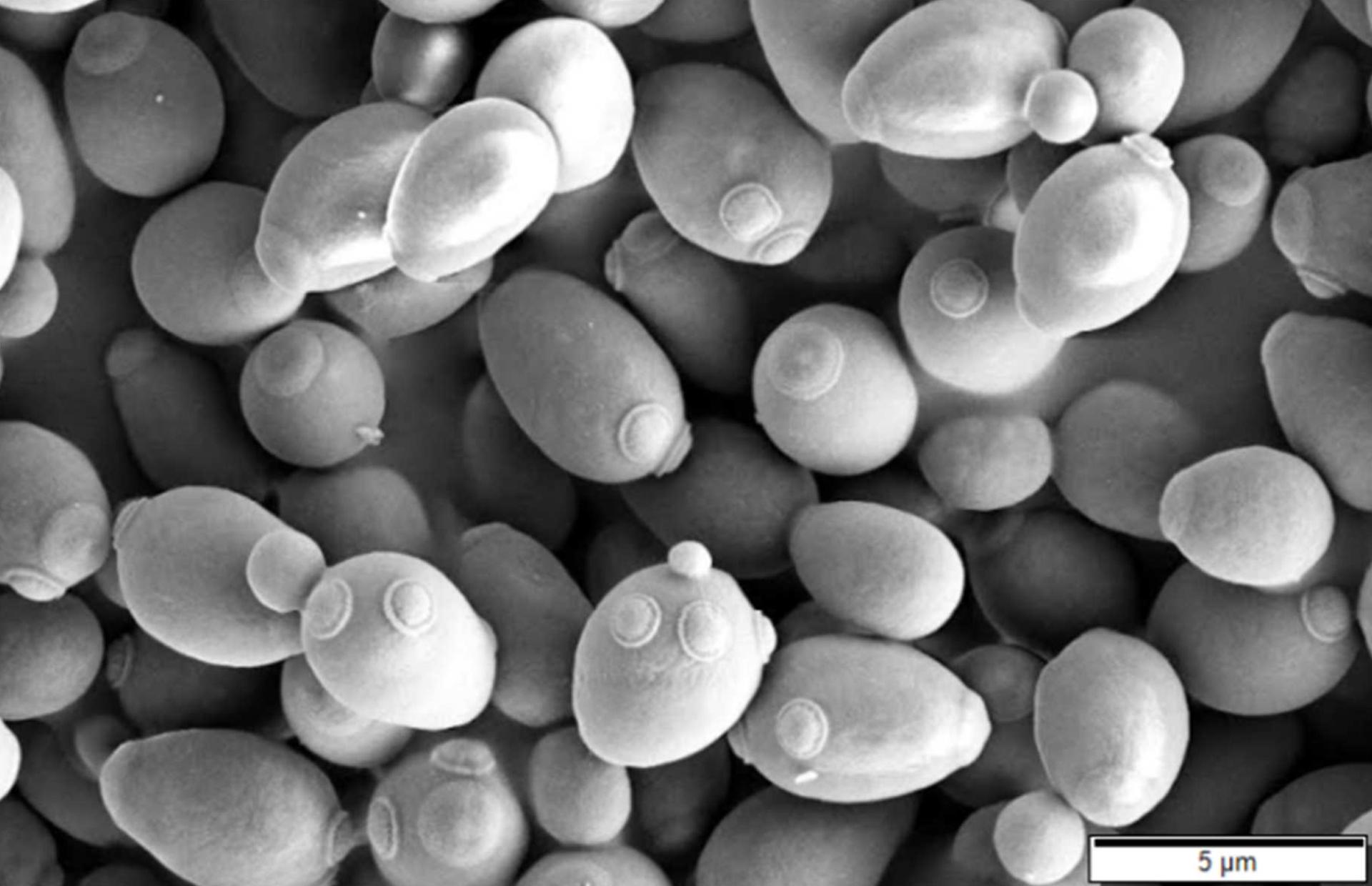 Saccharomyces cerevisiae under scanning electron microscopy. Species context for ethanol fermentation; the authorised Evolve Evergreen strain is not shown.